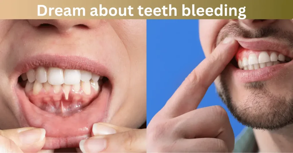 Dream About Teeth Bleeding: 7 Things It Secretly Reveals 3 Dream about teeth bleeding