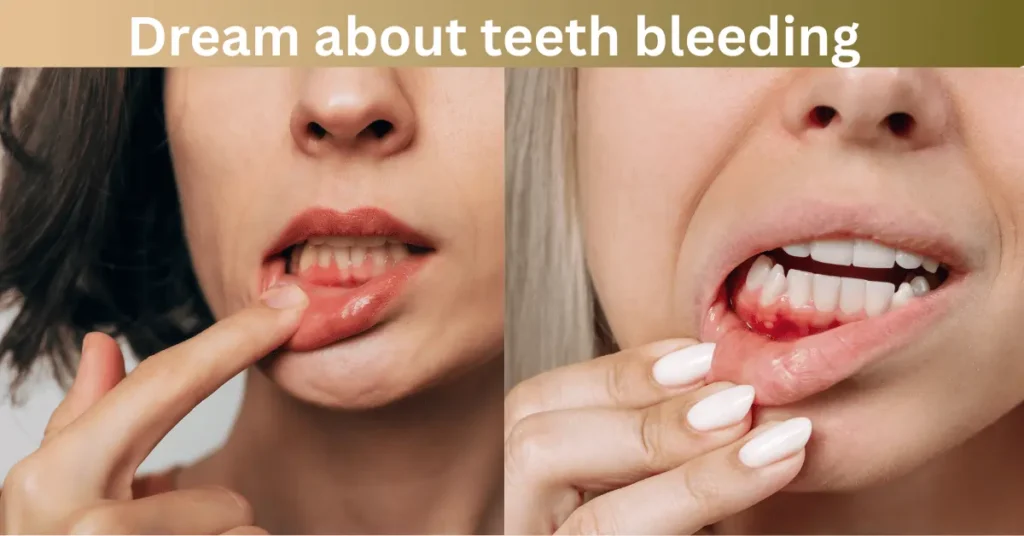 Dream About Teeth Bleeding: 7 Things It Secretly Reveals 2 Dream about teeth bleeding