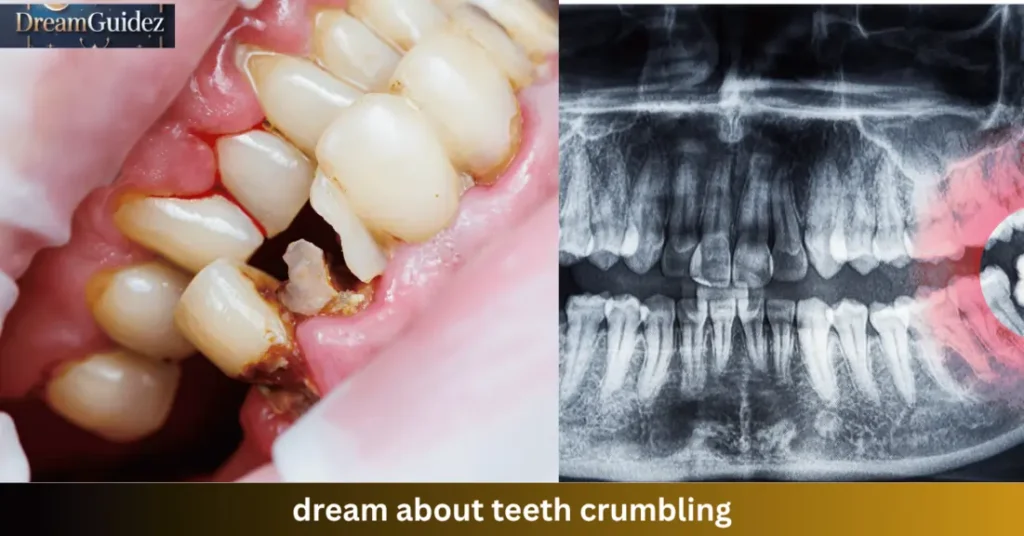 Dream About Teeth Crumbling: 5 powerful Spiritual & Biblical Insights You Must Know 2 dream about teeth crumbling
